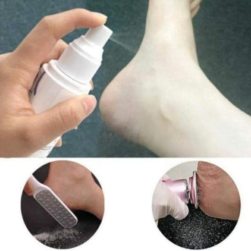 NƯỚC XỊT MỀM GÓT CHÂN