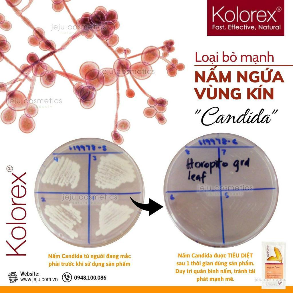 Gel vệ sinh giảm nấm ngứa Kolorex Vaginal Care Wash