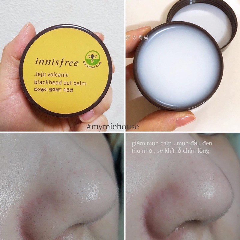 VOLCANIC BLACK HEAD OUT BALM - sáp loại bỏ mụn đầu đen | BigBuy360 - bigbuy360.vn