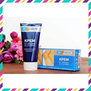 Kem nứt gót chân Kpem - Hàng Xách Tay Nga