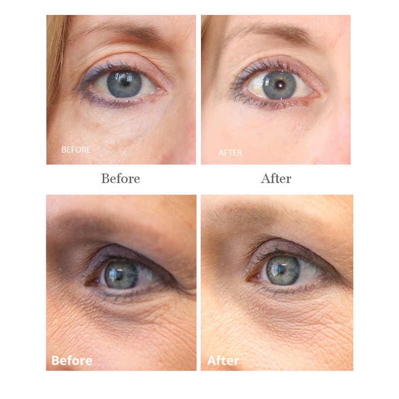 Kem mắt swisse | BigBuy360 - bigbuy360.vn