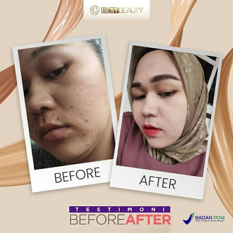 Bán chạy nhất Túi đựng đồ đẹp cuối cùng | BigBuy360 - bigbuy360.vn