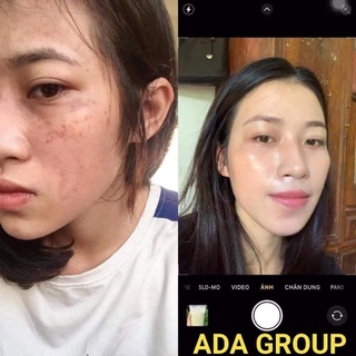 Serum căng bóng mờ thâm Mela White ADA GROUP