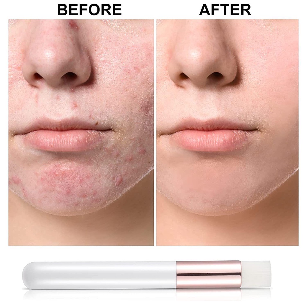 Bộ 32 Cọ Gội Đầu Làm Sạch Sâu Loại Bỏ Mụn Đầu Đen Tiện Dụng