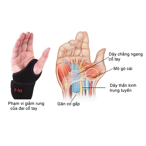 ✅ ĐAI CỔ TAY XỎ NGÓN IM NS-314 - Đai ổn định, giảm đau khớp cổ tay & mô gò cái, hội chứng ống cổ tay, chấn thương cổ tay