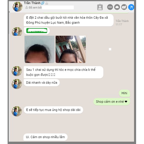 BỘ DẦU GỘI BƯỞI + TINH DẦU BƯỞI - Trị Rụng Tóc- Kích Thích Mọc Tóc NATULIFE | BigBuy360 - bigbuy360.vn