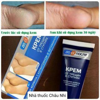 Kem trị nứt gót chân KPEM chính hãng của Nga 50ml