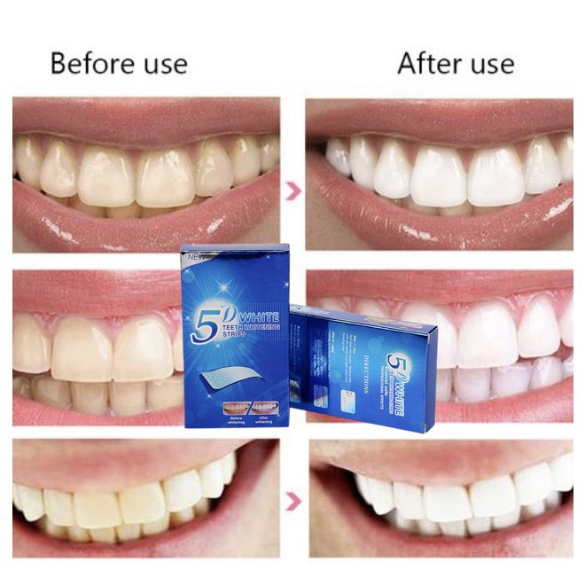 7 Gói - 14 Miếng Dán Trắng Răng 5D Whitening Strip Liệu Trình Dưỡng Trắng Răng