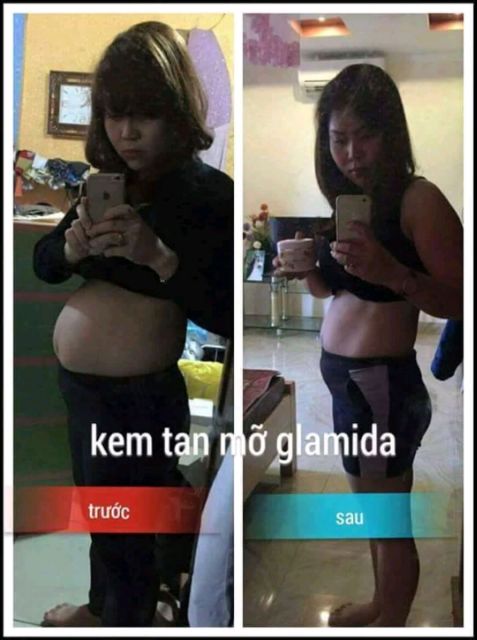 ( SỈ = LẺ) combo đai quấn + kem glamida | BigBuy360 - bigbuy360.vn