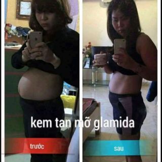( SỈ = LẺ) combo đai quấn + kem glamida