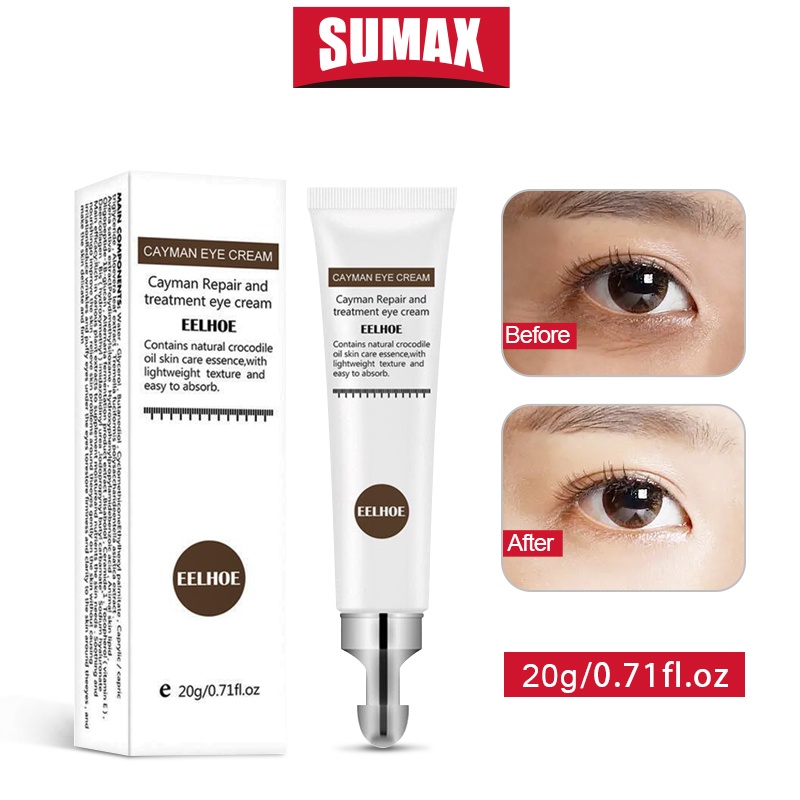 Kem dưỡng da mắt SUMAX chống lão hóa xóa mờ quầng thâm/ bọng mắt dưỡng ẩm hiệu quả 20g