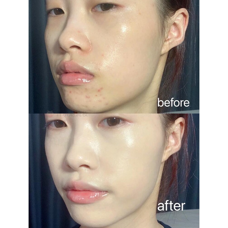 Unny Club Kem nền che khuyết điểm dạng lỏng dưỡng ẩm làm sáng tông màu da không tì vết | BigBuy360 - bigbuy360.vn