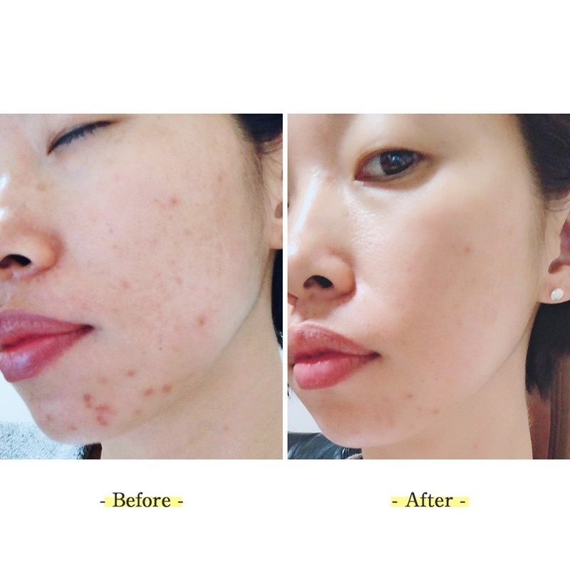 Kem Dưỡng Da Rohto Melano CC Từ Nhật Bản Rohto Melano CC Vitamin C Dưỡng Ẩm Và Làm Trắng Da 20g