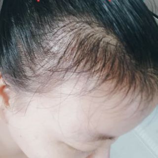 Dầu gội thảo dược Come_on