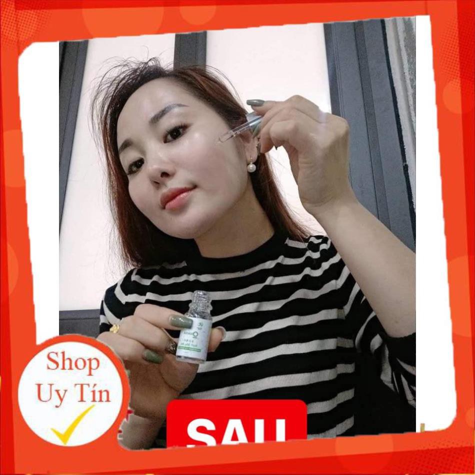 Đặc trị mụn Huyết Hồng Sâm - 100% từ thảo mộc thiên nhiên, giá rẻ - Đông Dược Vũ Đức | BigBuy360 - bigbuy360.vn