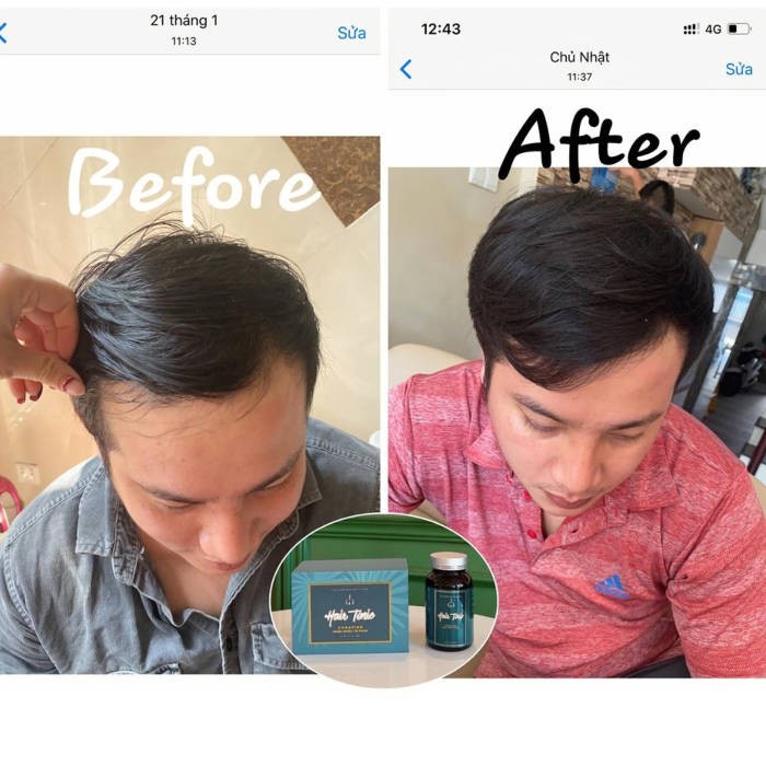 Liệu trình 3 hộp Viên uống kích mọc tóc Hair Tonic phục hồi tóc khô xơ gãy rụng