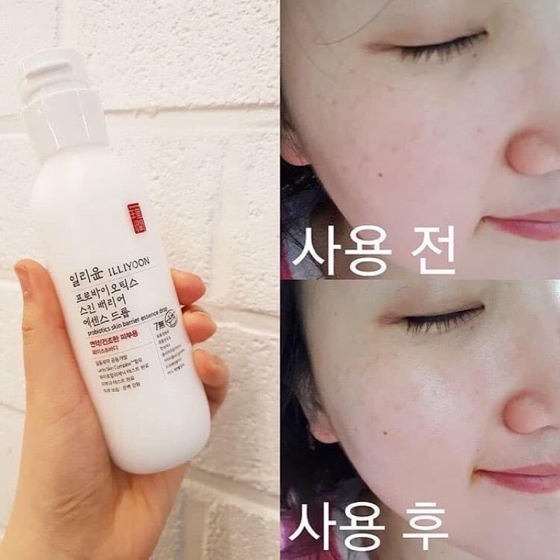 ILLIYOON dưỡng ẩm trắng da tính chất men vi sinh Probiotics Skin Barrier Essence Drop Set chính hãng