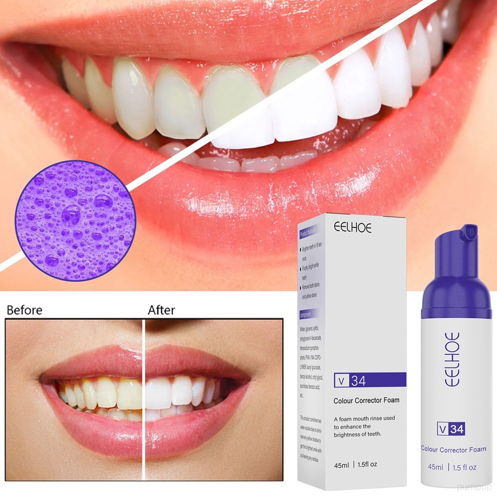 Tuýp Kem Đánh Răng V34 45ml Làm Trắng Loại Bỏ Vết Bẩn Thoáng Khí Màu Sắc Tươi Tắn