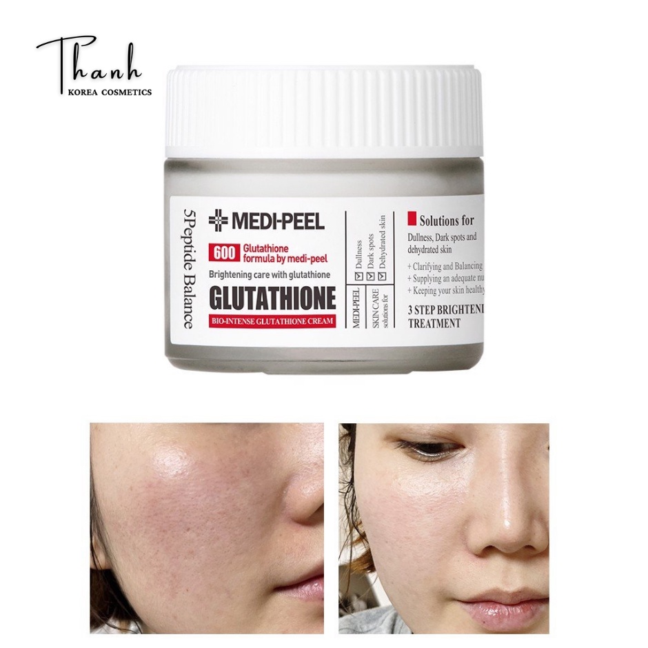 Kem Dưỡng Trắng MEDI-PEEL Glutathione 600 White Cream Sáng Da Medi Peel Hàn Quốc 50ml