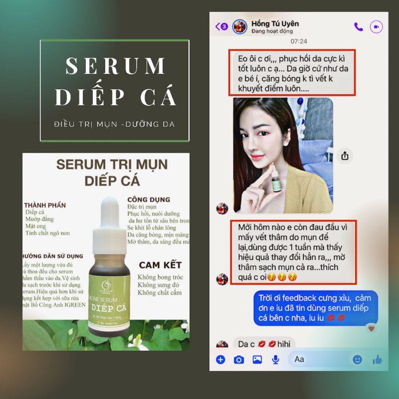 Serum Diếp Cá Igreen đánh bay mụn | BigBuy360 - bigbuy360.vn