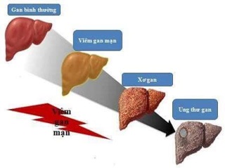 Cà gai leo khô 1 kg