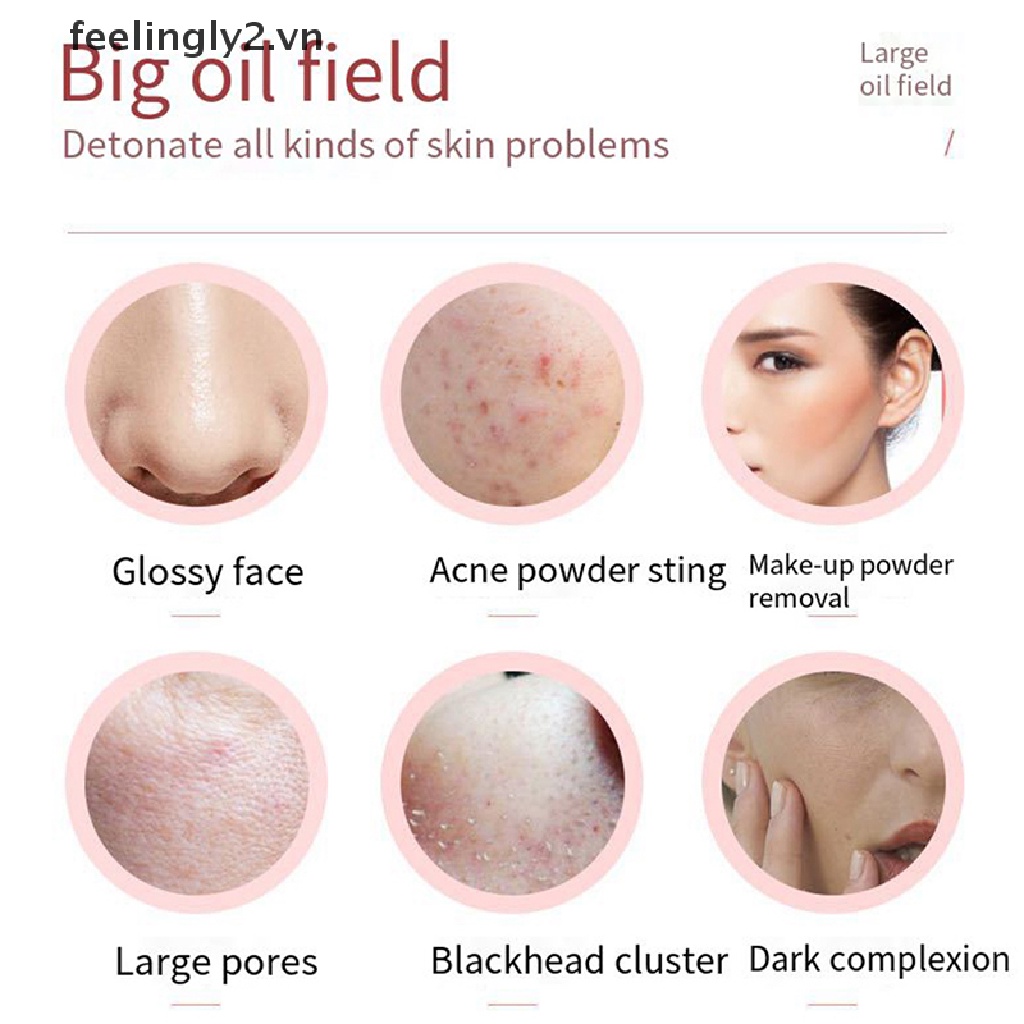 (Hàng Mới Về) Con Lăn Thấm Dầu Giảm Mụn Cầm Tay