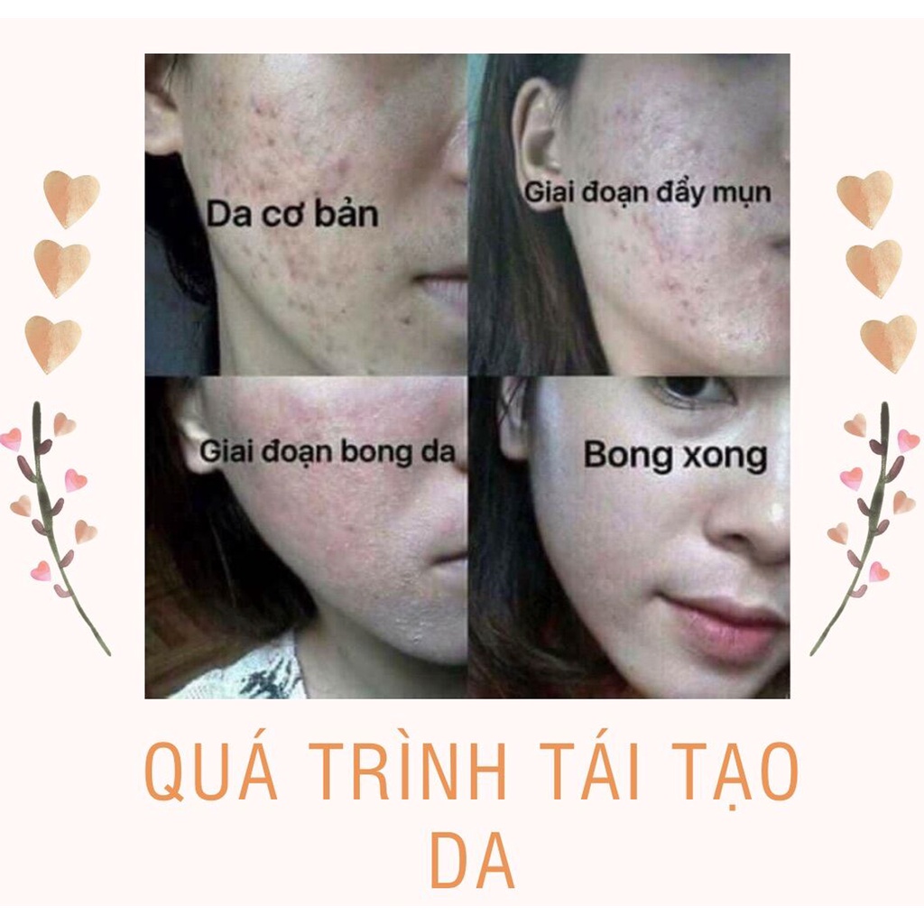 COMBO Tái Tạo Da Sắc Dược Thiên + Bột Rửa Mặt chính hãng Cải Thiện tận gốc mụn, nám rỗ, tàn nhan