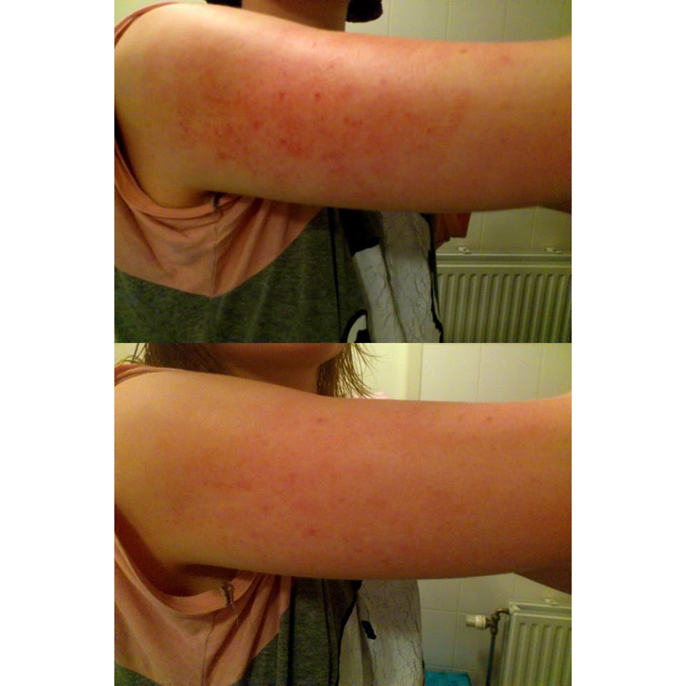 Kem dưỡng thể giảm viêm nang lông PLC 2% BHA | BigBuy360 - bigbuy360.vn