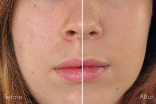 Bộ đôi 2 tuýp kem lót và kem nền U2B+ professional chính hãng | BigBuy360 - bigbuy360.vn