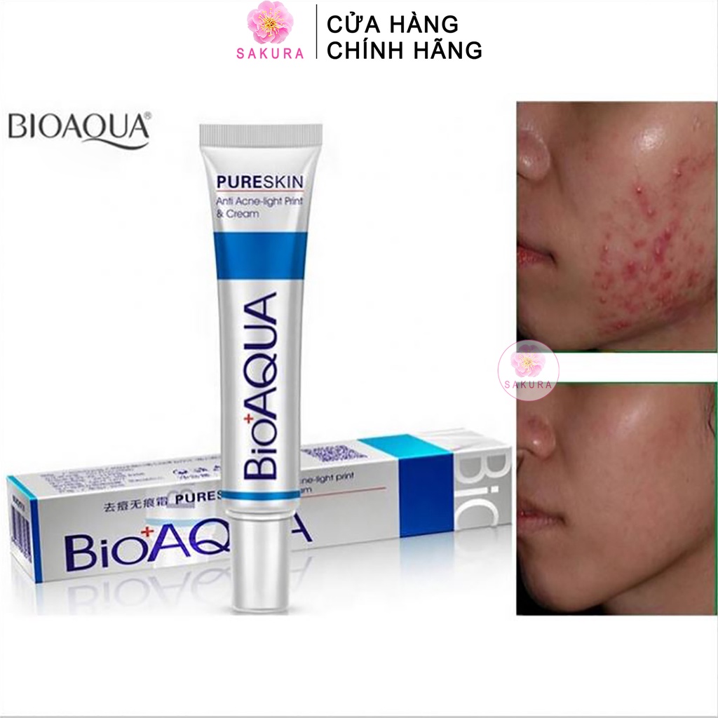 Kem mụn trứng cá BIOAQUA Pure Skin kiểm soát dầu dưỡng ẩm chăm sóc da mặt nội địa trung SAKURA 30g