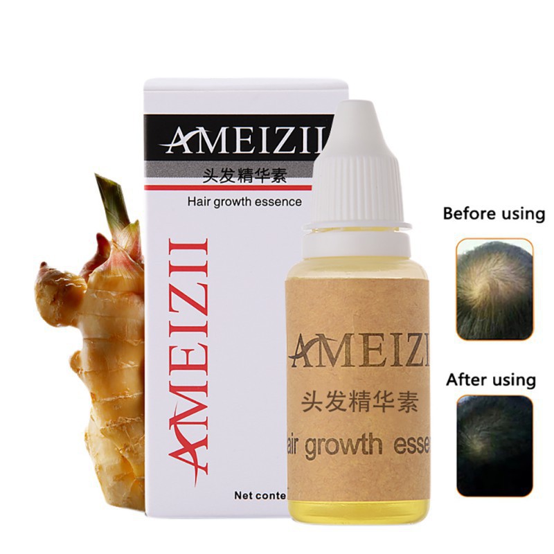 Tinh chất tăng trưởng và nuôi dưỡng tóc AMEIZII 200ml chất lượng cao