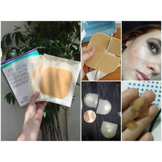 Combo 5 Miếng Dán Nhanh Xẹp Mụn Mủ DuoDerm Extra Thin