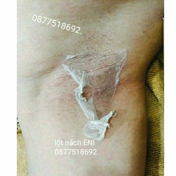 Lột Thay Da Nách Xóa Thâm Hết Sạm Mịn Da