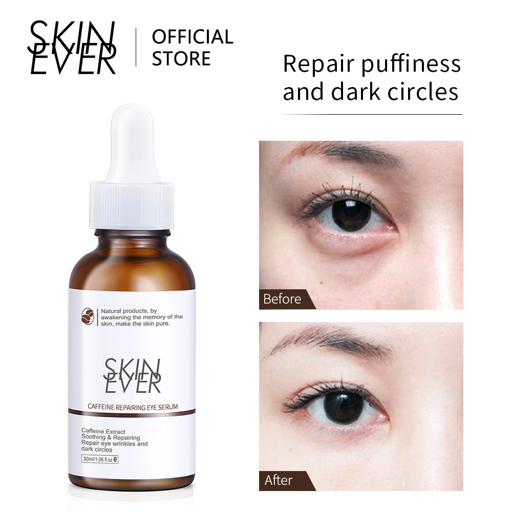 Set serum + kem SKIN EVER caffeine phục hồi da mắt giảm nếp nhăn phù nề và quầng thâm | BigBuy360 - bigbuy360.vn