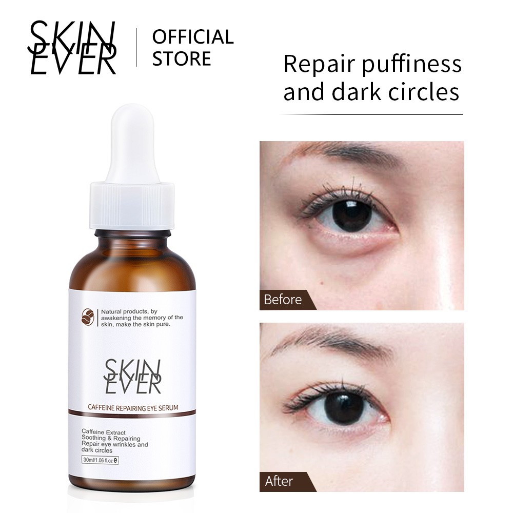 Set serum + kem SKIN EVER caffeine phục hồi da mắt giảm nếp nhăn phù nề và quầng thâm