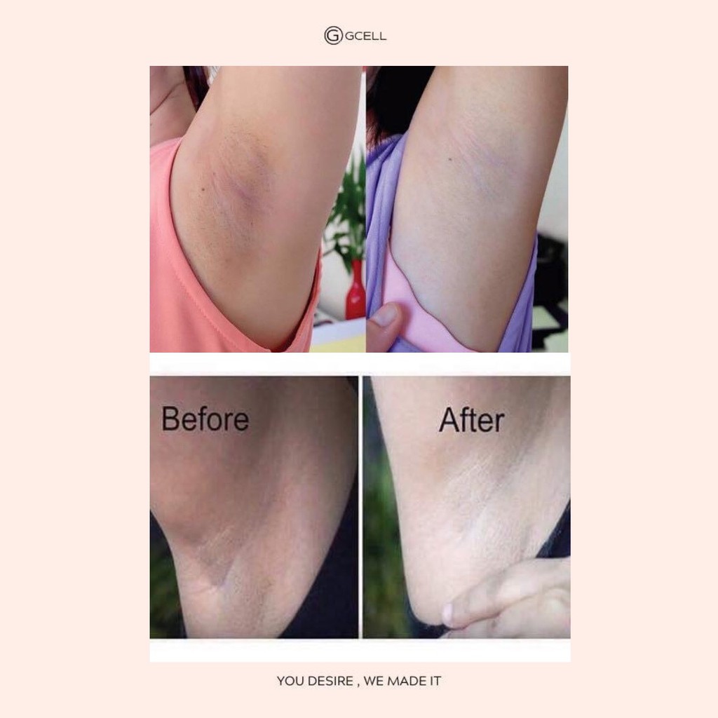 KEM LÀM TRẮNG NÁCH BẸN MÔNG GCELL XXVIRGIN A6