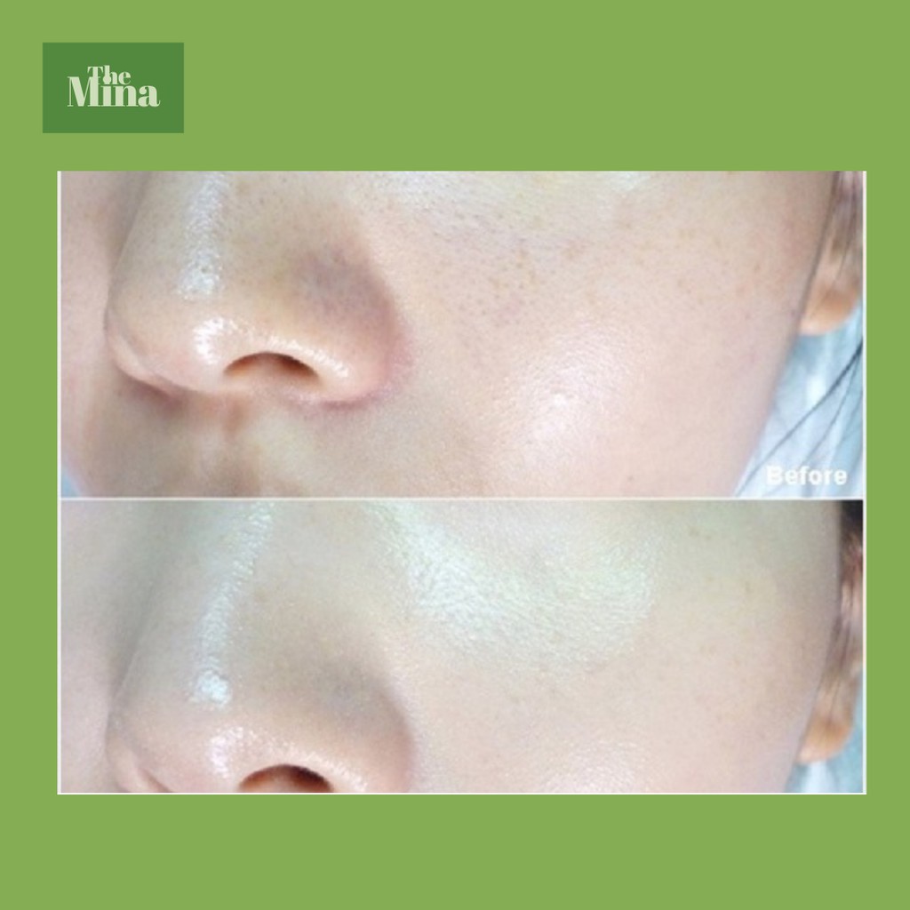 (Hàng sẵn - đủ bill) Serum Collagen Teana C1