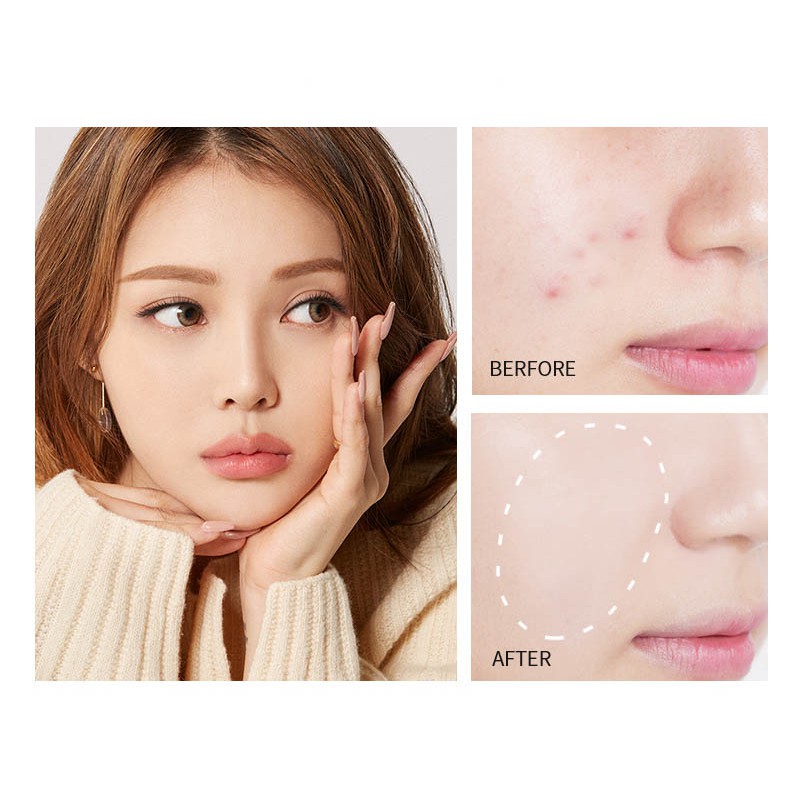 (Sỉ) Kem Che Khuyết Điểm Mịn Lì Tiệp Mọi Tông Da Kiểm Soát Dầu Hoa Sen Lameila Concealer The Saem Cover Perfection K18