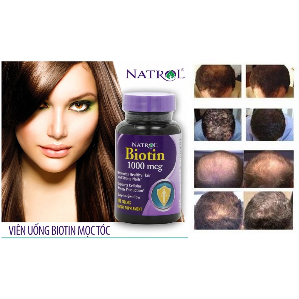 Biotin 10,000mcg Hỗ Trợ Tóc, Da, Móng Tay, Chống Rụng Tóc, 100viên