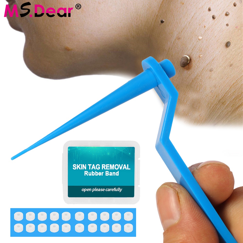 Bộ Dụng Cụ Tẩy Nốt Ruồi Mụn Cóc Chăm Sóc Da Cho Người Lớn