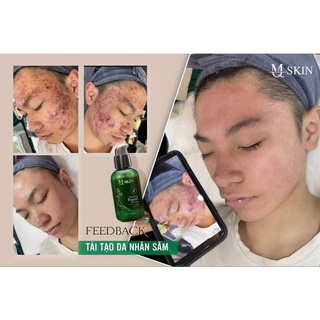 SERUM THAY DA NHÂN SÂM