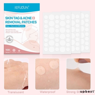 [Hàng mới về] Miếng dán tẩy mụn thịt & mụn trứng cá Hydrocolloid chống nhiễm trùng hút nhanh chăm sóc mặt Sefudun