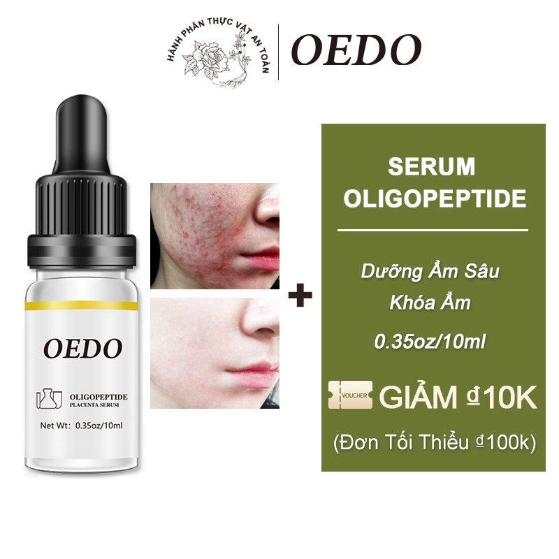 OEDO Serum dưỡng da Oligopeptide Placenta Ẩm Làm Trắng Da Chống Lão Hóa Chống Nhăn Dưỡng Ẩm Sâu nếp nhăn 10ml