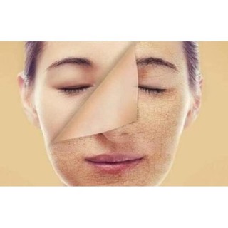 Hhung Kem tẩy tế bào chết Marosa_ mỹ phẩm thiên nhiên Laco.