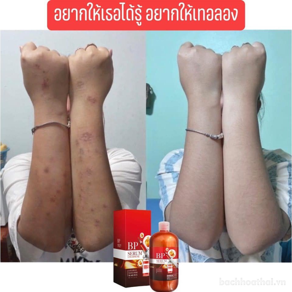 Serum dưỡng thể ƙích trắŉg da cà chua BP Lycopene Thái Lan