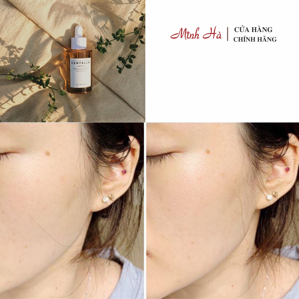 Serum rau má Skin1004 Madagascar Centella Asiatica Ampoule 100 ml giảm mụn phục hồi da