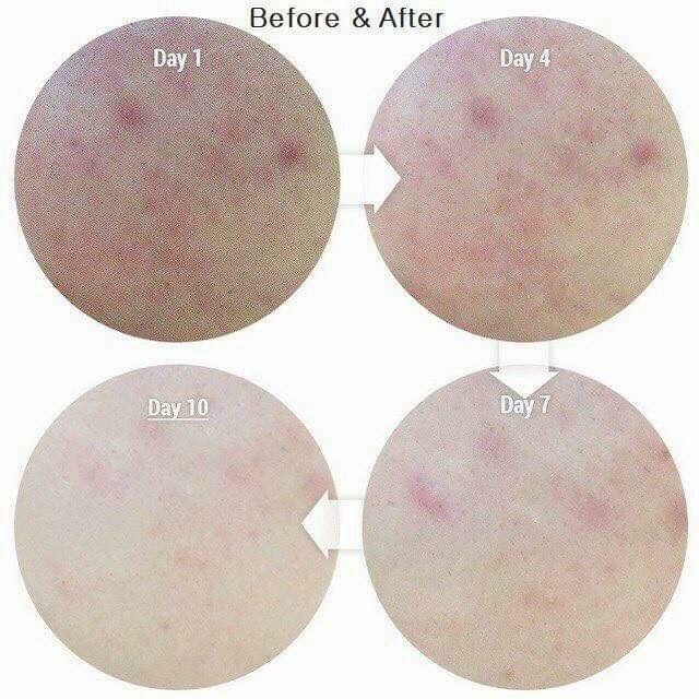 Kem Dưỡng Melano CC 23g Cream Nhật