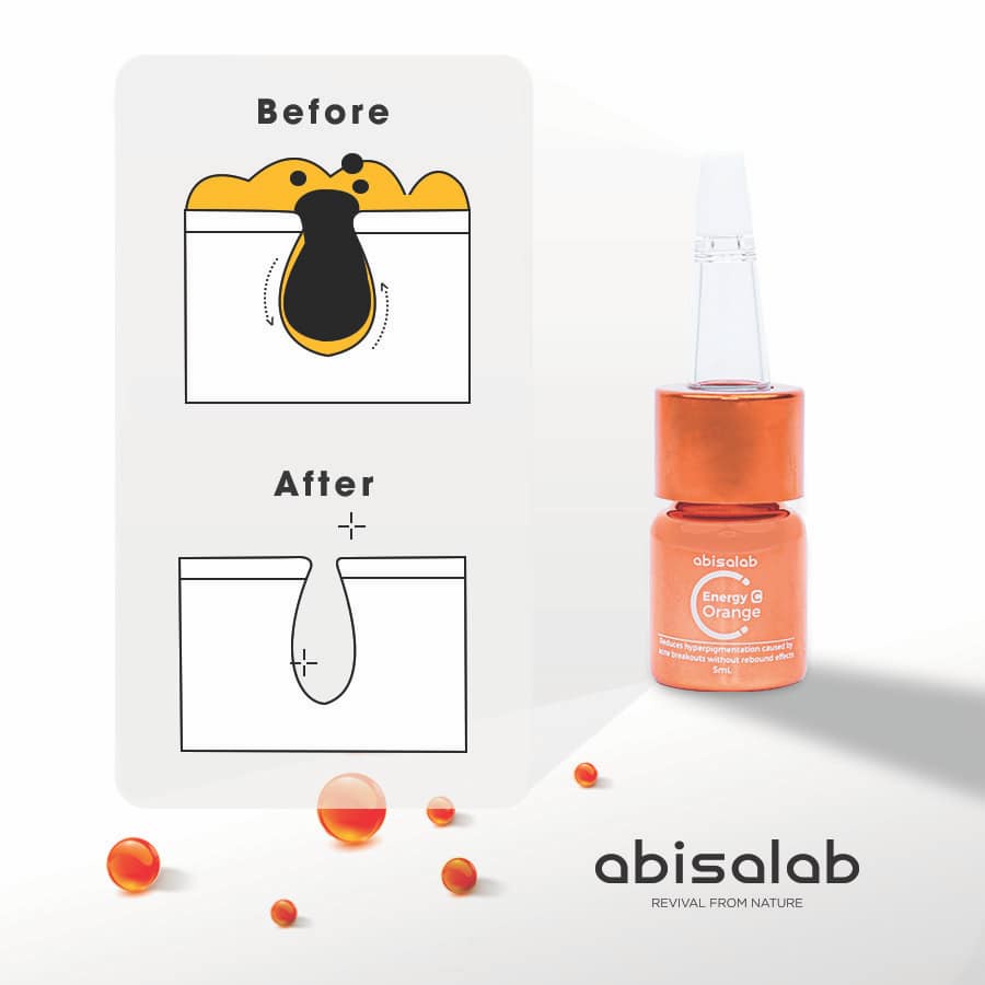 Tinh chất dành cho da mụn Abisalab Energy C Orange 5ml