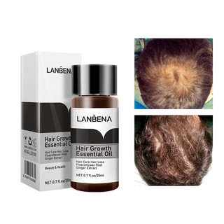 Tinh dầu kích thích mọc tóc LANBENA 20ml