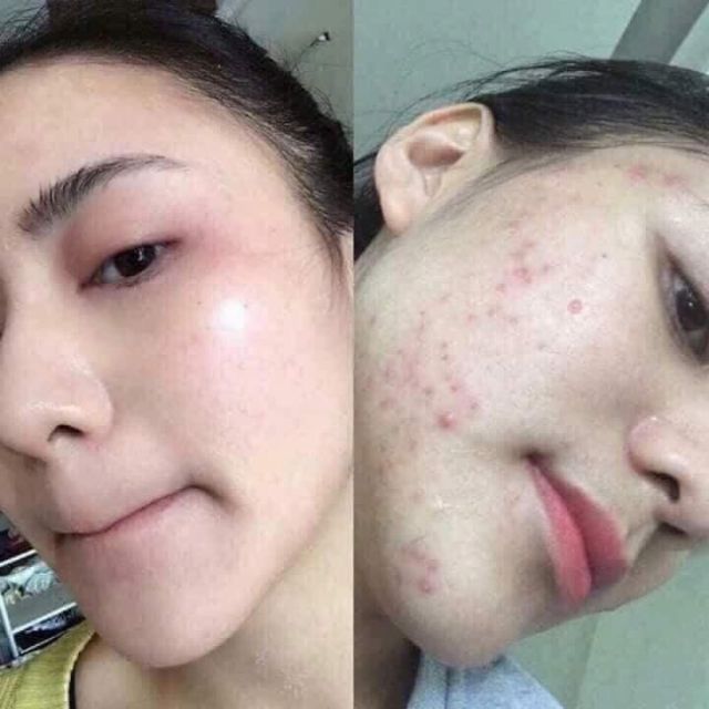 Kem tái tạo TA face đỏ cao cấp